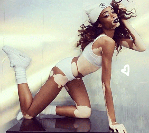 46298c617278162b686d1e83a9df126a