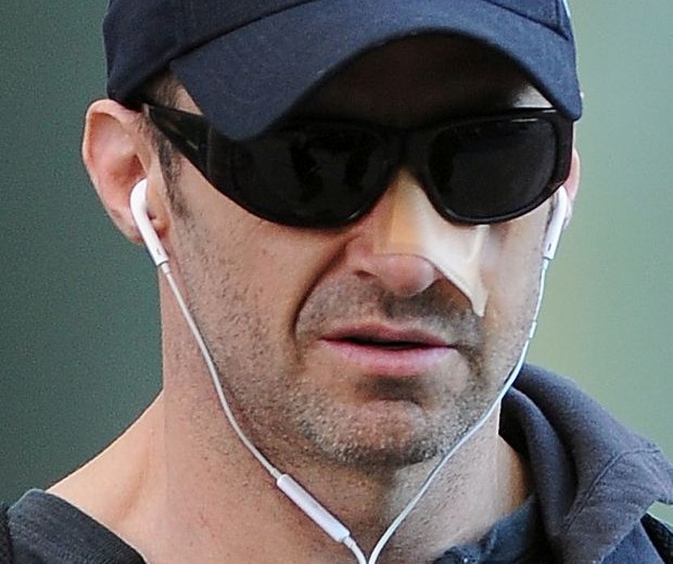 EXCLUSIVE: Hugh Jackman departs his Manhattan residence with a bandage on his nose