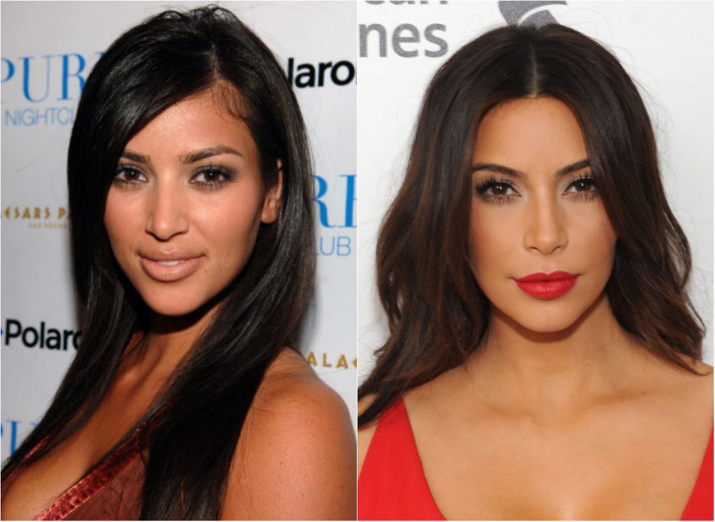 kim-kardashian-before-and-after-plastic-surgery-3