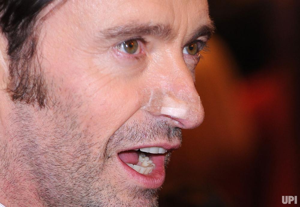 hugh-jackman-premieres-logan-at-the-67th-berlin-international-film-festival_10_1