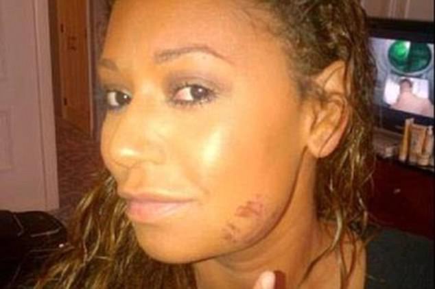 mel b2